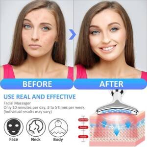 Sculpt Your Skin to Perfection: Facial Beauty Device for Lifting and Skin Care - Image 2